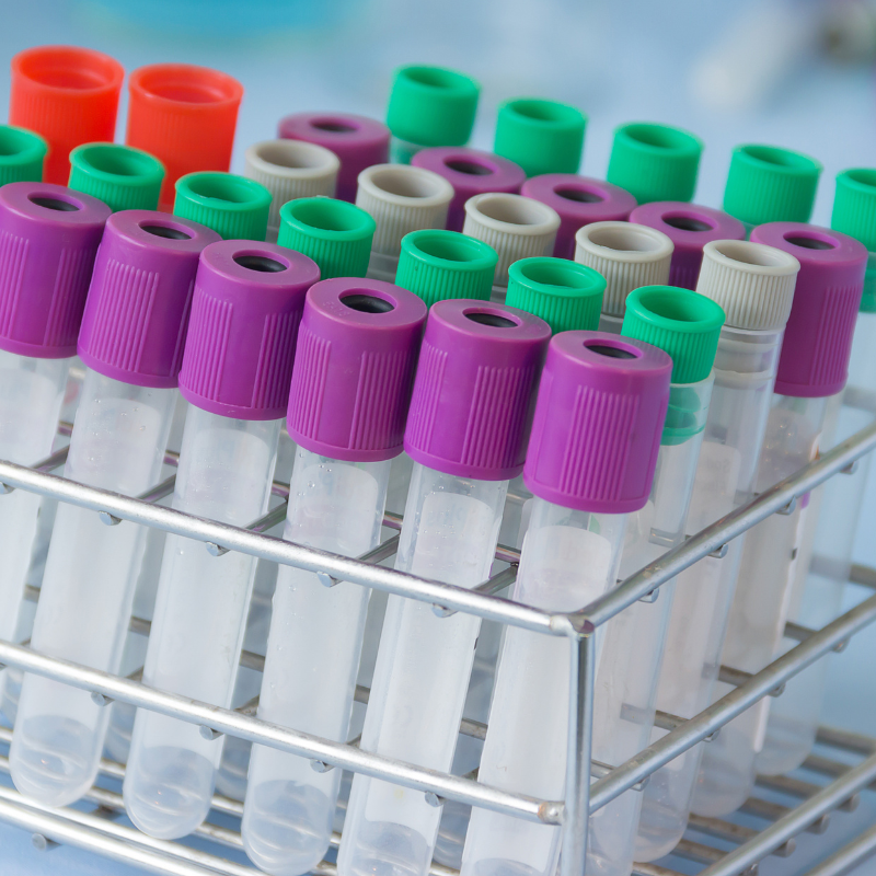 検体管理業界向けRFID導入事例